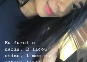 JOVEM QUASE MORRE POR CAUSA DE UM PIERCING…(FOTOS)