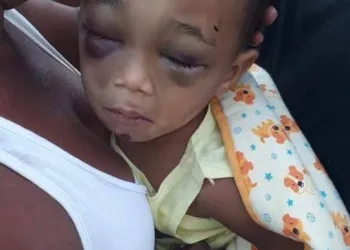 PEDIDO DE ORAÇÃO!!BEBÊ É ESPANCADO E ESTÁ INTERNADO EM HOSPITAL NA ZONA OESTE!!( FOTOS)