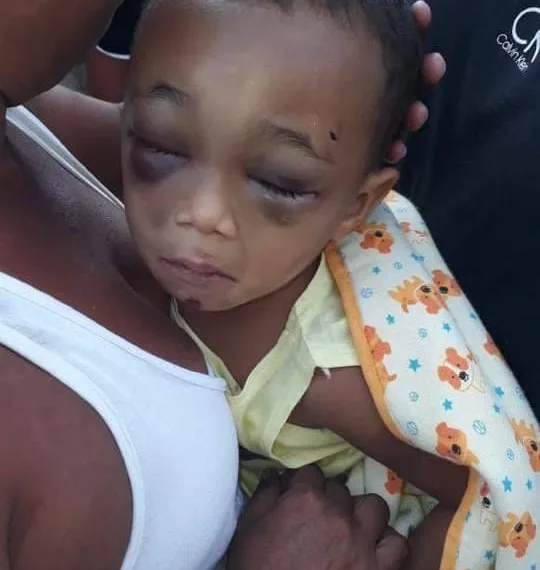 PEDIDO DE ORAÇÃO!!BEBÊ É ESPANCADO E ESTÁ INTERNADO EM HOSPITAL NA ZONA OESTE!!( FOTOS)
