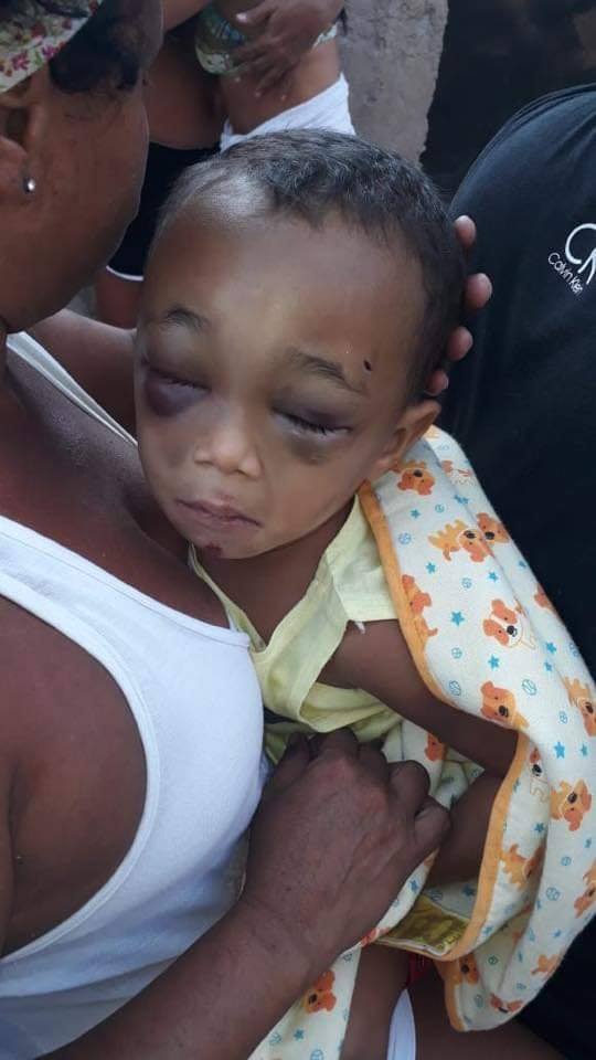 PEDIDO DE ORAÇÃO!!BEBÊ É ESPANCADO E ESTÁ INTERNADO EM HOSPITAL NA ZONA OESTE!!( FOTOS)