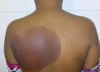ALERTA!! PISCINA!! QUASE PERDI MEU FILHO!! CUIDADO!!
