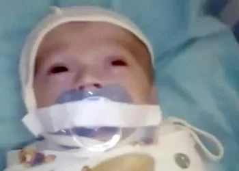 Bebê de 3 meses tem chupeta mantida presa por esparadrapo em hospital