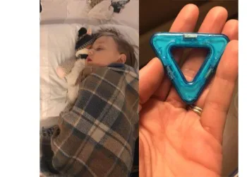 Criança engole 13 ímãs de brinquedo e mãe faz alerta no Facebook