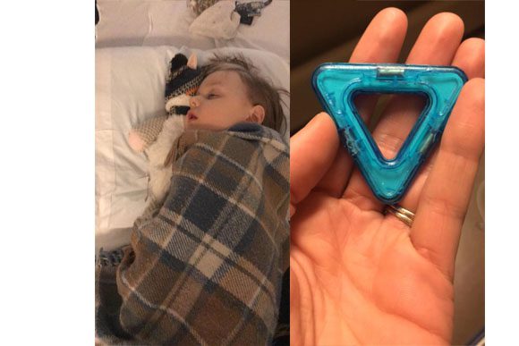 Criança engole 13 ímãs de brinquedo e mãe faz alerta no Facebook