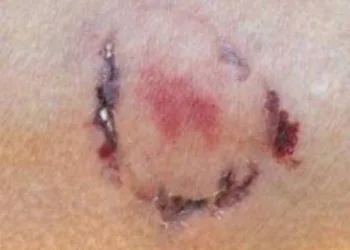 Mulher é atacada por cão e mordida pela dona do animal