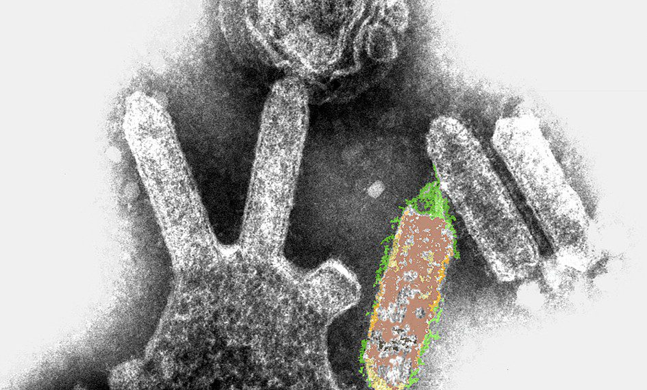 Mulher diagnosticada com síndrome do pânico tinha vírus mortal da raiva