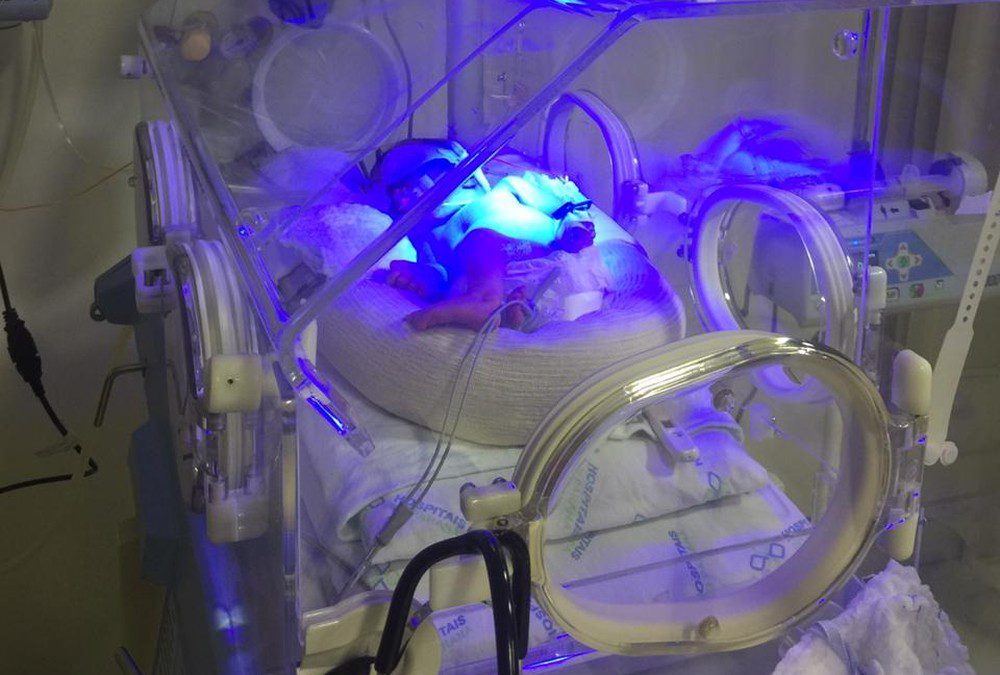 Em caso raro, gêmeas nascem com três dias de diferença, em Francisco Beltrão