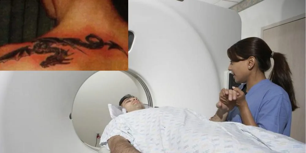 Pessoas tatuadas podem ter queimaduras na pele durante ressonância magnética!