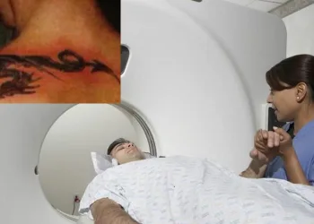 Pessoas tatuadas podem ter queimaduras na pele durante ressonância magnética!