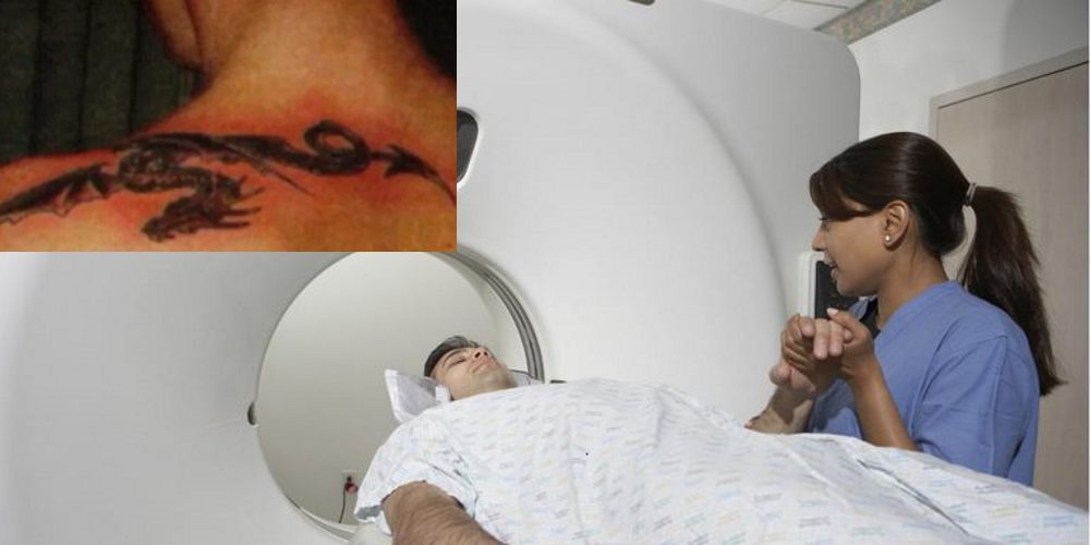 Pessoas tatuadas podem ter queimaduras na pele durante ressonância magnética!