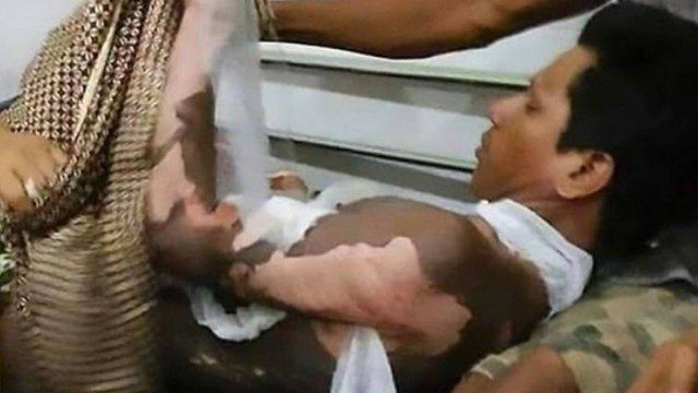 Mulher incendeia o marido após ele se recusar a dar a senha do celular a ela