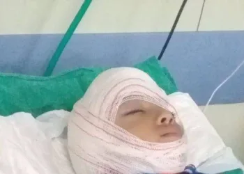 Criança tem traumatismo craniano após ser atingida por poste em praça no Rio