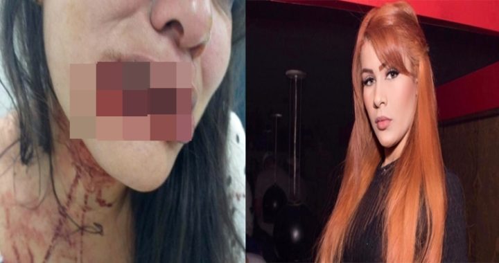 Delegada pede prisão de Blogueira que arrancou 80% do lábio de mulher(IMAGEM FORTE)