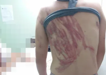 Mulher é chicoteada com fio elétrico pelo marido no RJ