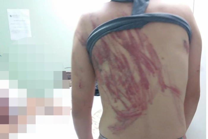 Mulher é chicoteada com fio elétrico pelo marido no RJ