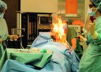 Paciente sofreu queimaduras graves por soltar gases durante cirurgia a laser