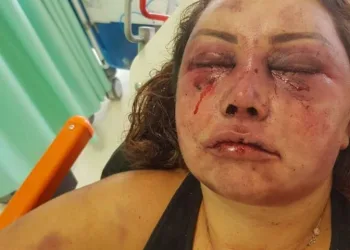 “Não consigo reconhecer minha irmã”, diz irmão de mulher espancada por 4h