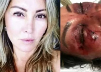 Empresária agredida no primeiro encontro manda alerta para mulheres