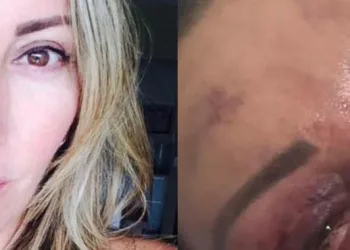 Mulher espancada no RJ pode deixar a UTI hoje….