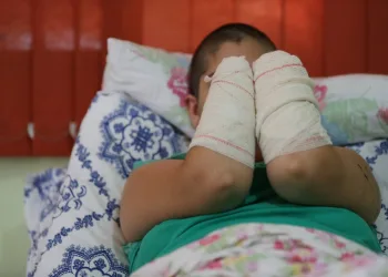 Homem que decepou mãos da ex-companheira tem pena reduzida