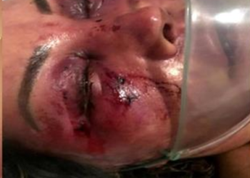 Mulher é espancada no Rio por jovem que conheceu na internet  agressor é preso em flagrante