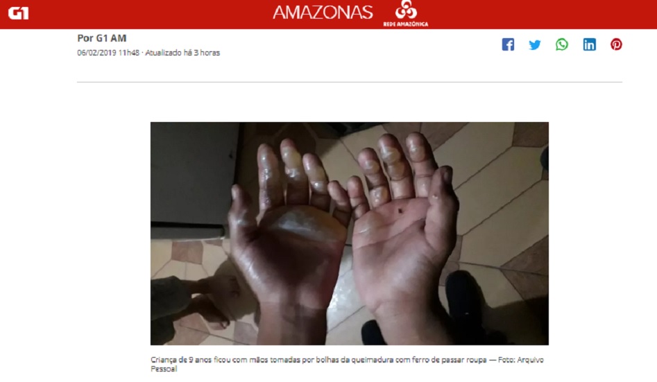 Mulher é acusada de queimar as mãos do filho com ferro de passar roupa