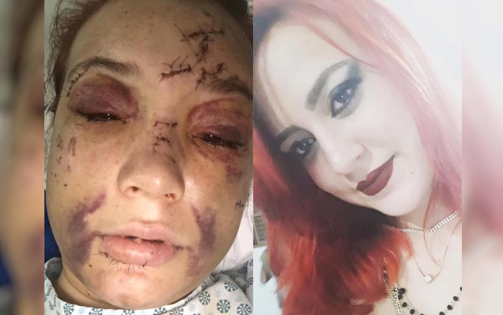 Motorista da Uber confessa que agrediu passageira achada ensanguentada e mentiu que tinha sido roubado por ela