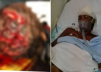 Homem é preso após tentar matar companheira com enxadão no RJ