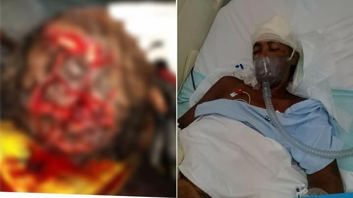 Homem é preso após tentar matar companheira com enxadão no RJ