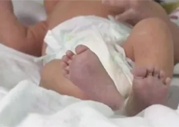 BEBÊ É ENCONTRADO DENTRO DE LIXEIRA NO RJ