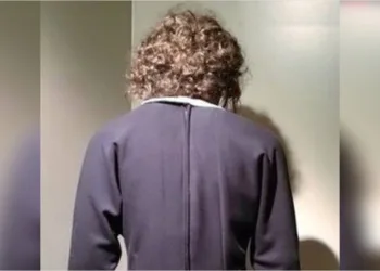 Conheça a mulher considerada a mais feia do mundo; muitas pessoas preferem não olhar para ela