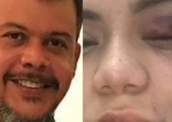 Médico que espancou a esposa se apresenta na delegacia da mulher