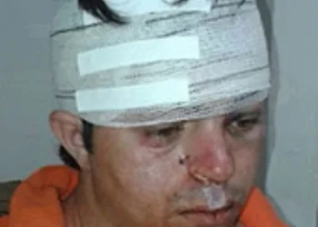 Homem é espancado por se recusar em ir para cama com esposa e amiga