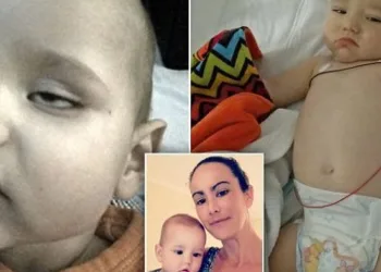 Bebê quase morre com meningite após sentar em carrinho de supermercado. Médicos disseram ser apenas “virose”!