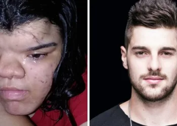 DJ Alok doa R$ 30 mil para jovem realizar cirurgia reparadora no rosto