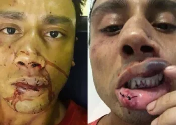 Gay é espancado por seis Homens no Rio de Janeiro