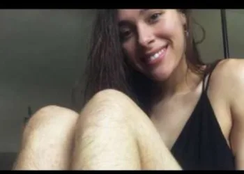 Você se lembra da garota que ficou 1 ano sem se depilar? Veja como ela está atualmente!