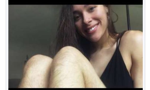 Você se lembra da garota que ficou 1 ano sem se depilar? Veja como ela está atualmente!
