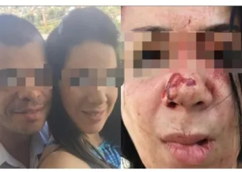 Mulher denuncia que marido pastor lhe espancou na frente dos filhos e fugiu