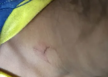 Casal de lésbicas do mal é preso por torturar menina de 4 anos