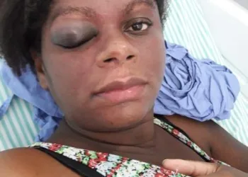 Grávida de 8 meses é agredida pelo marido; ele alega “cabeça quente”
