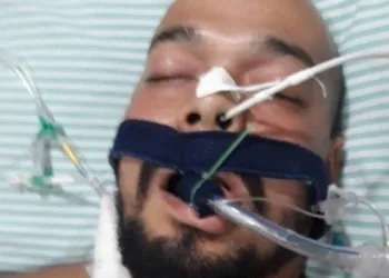 Chefe do tráfico é preso em hospital após se ferir com o próprio fuzil: ‘Acidente de trabalho’