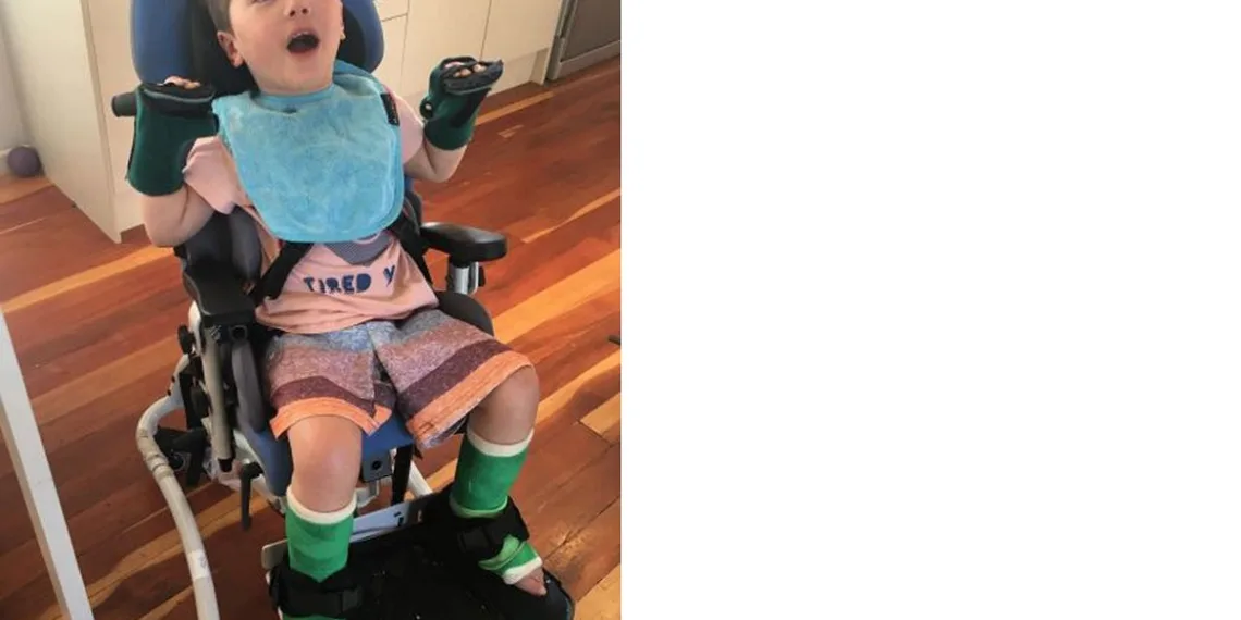 Menino fica paraplégico após engasgar com pedaço de maçã na creche e caso serve de alerta