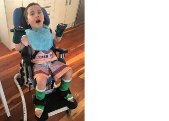 Menino fica paraplégico após engasgar com pedaço de maçã na creche e caso serve de alerta