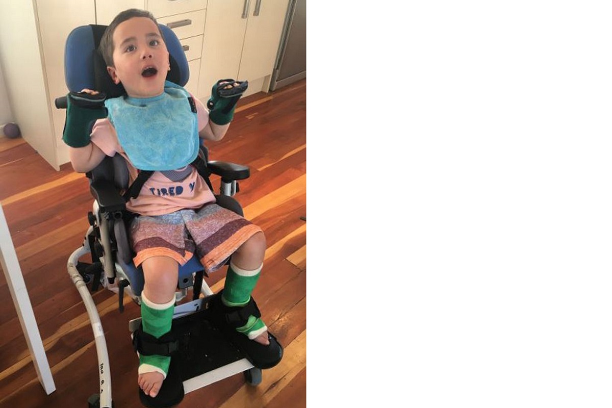 Menino fica paraplégico após engasgar com pedaço de maçã na creche e caso serve de alerta