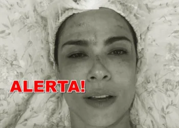 Alerta! Clientes contraem HIV em tratamento facial inovador feito até por Luciana Gimenez