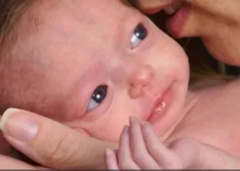 Esta bebê envelhece 7 vezes mais rápido, veja como ela está ao completar 8 anos