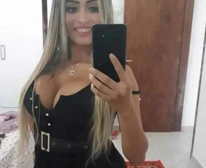 Jovem de 25 anos morre após aplicação de silicone nos glúteos