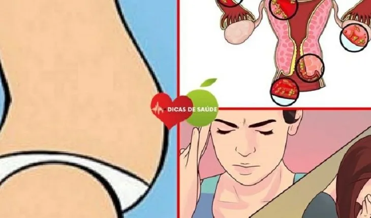 Câncer no ovário pode matar silenciosamente: veja 10 sintomas que são verdadeiros alertas