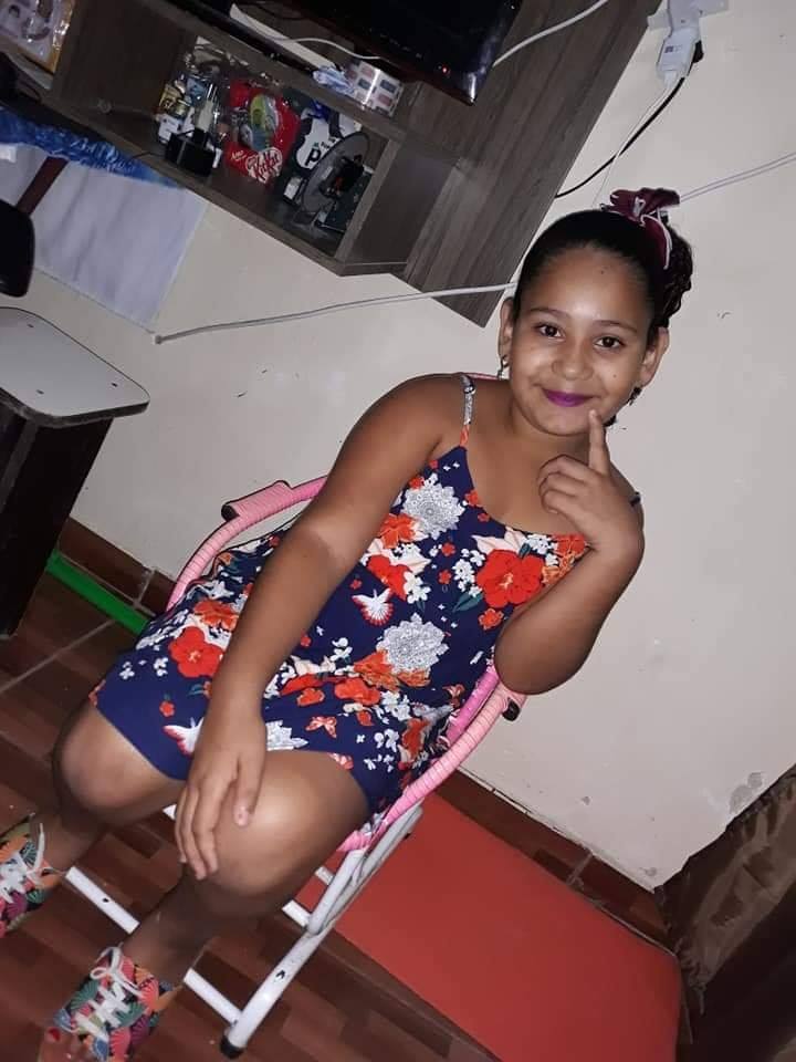 MENINA DE 8 ANOS ATINGIDA POR LINHA CHILENA EM REALENGO PODE TER PERNA AMPUTADA